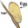 Illustration of a nit.